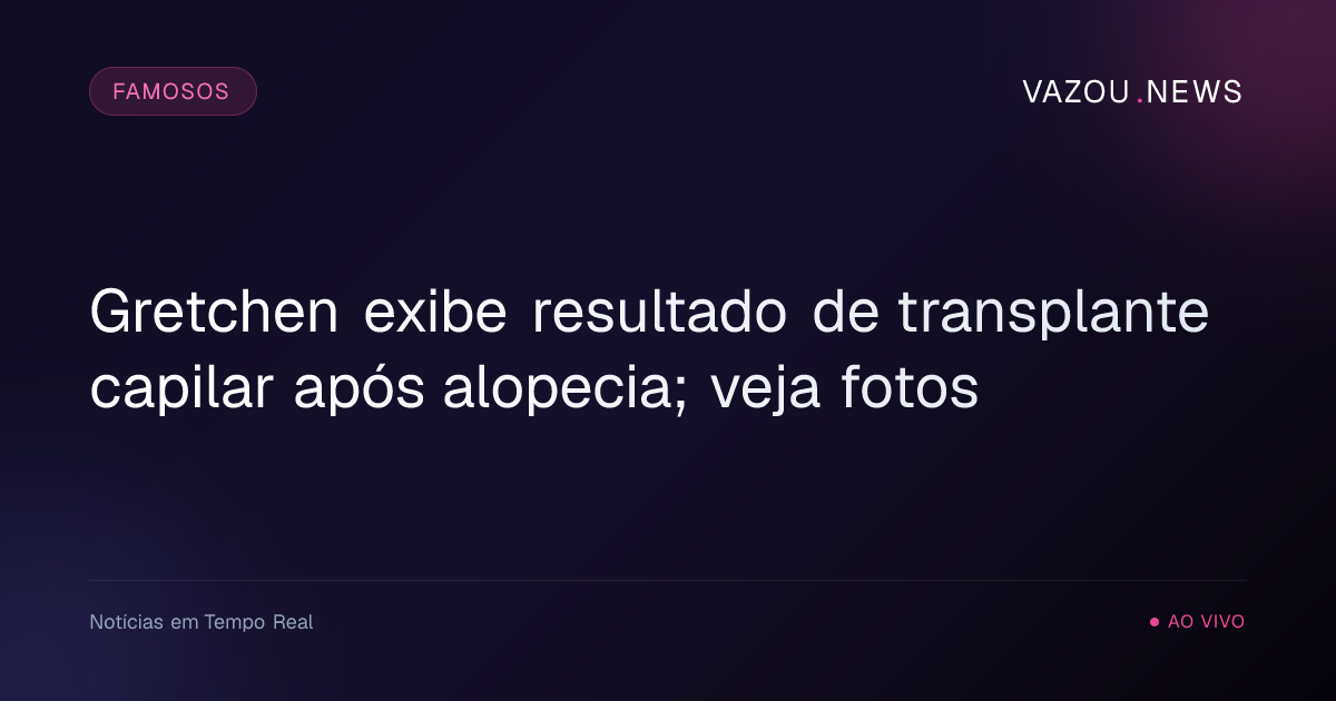 Gretchen exibe resultado de transplante capilar após alopecia; veja fotos